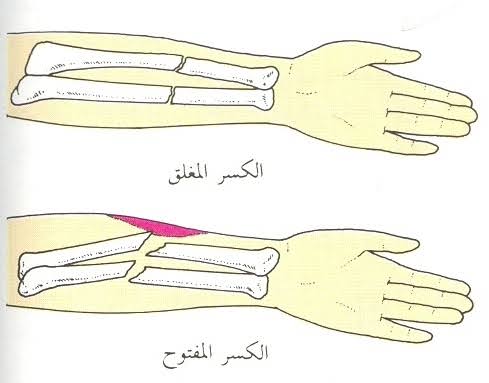 الإسعافات الأولية 