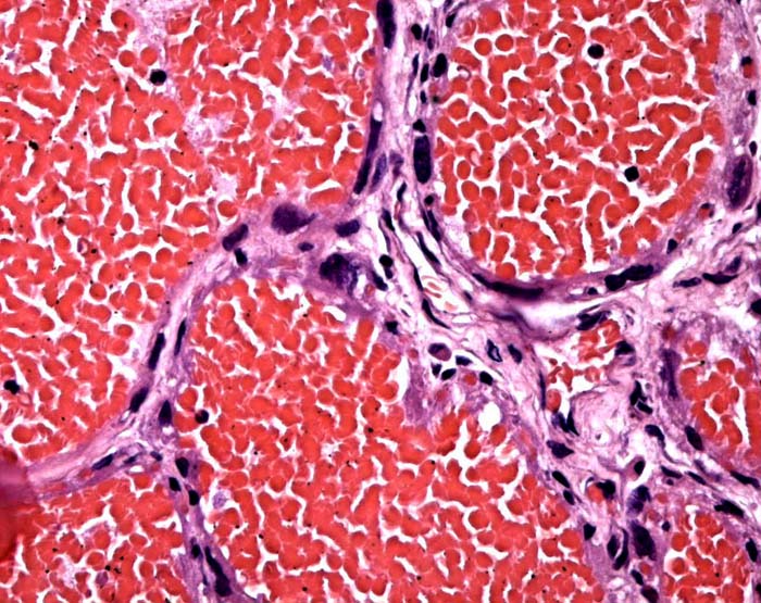 Labyrinthine portion with occasional giant cells next to endothelium