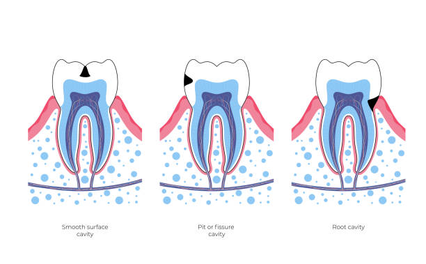 Endodontic Courses in India