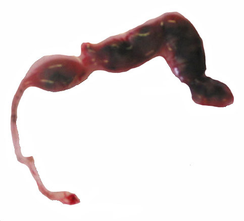 Uterus with six immature gestations; only one is in the left horn that had at least three resorption sites.