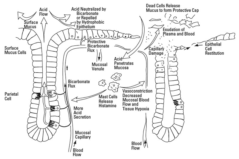 The normal gastric mucosal barrier (left) and the broken gastric mucosal barrier (right)