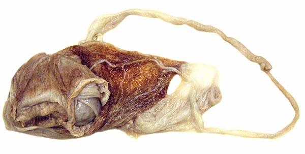 Formalin-fixed beaver placenta with cord