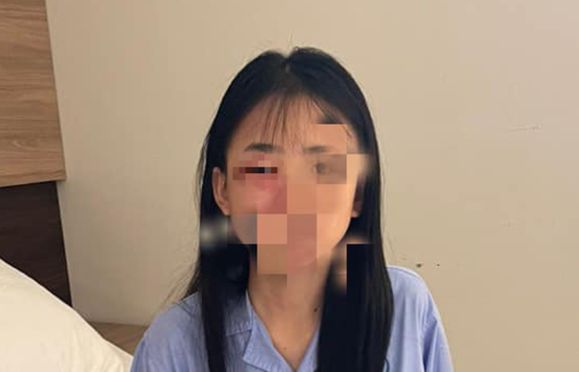 Nữ sinh lớp 8 nhập viện sau khi bị đánh hội đồng