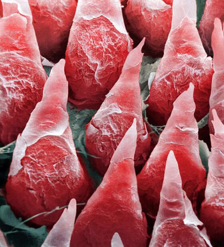 A-microscopic-image-of-a-human-tongue