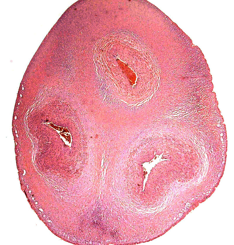 Cross section of the normal placenta.