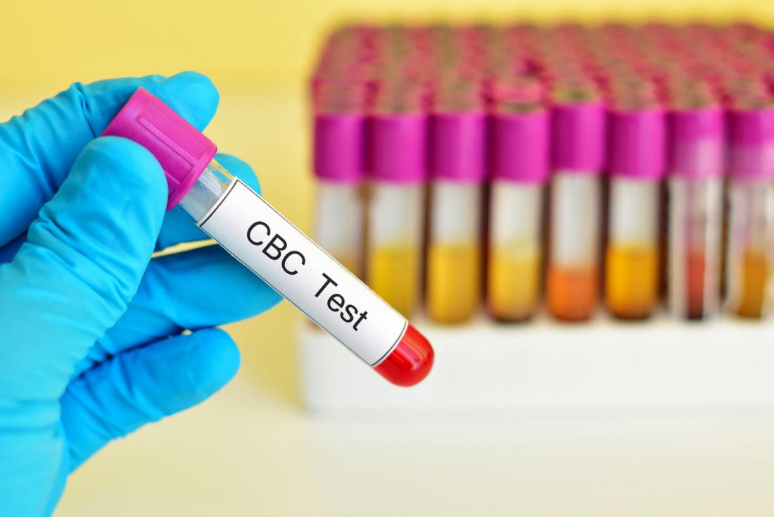 a misdiagnosis of fibromyalgia due to abnormal CBC results