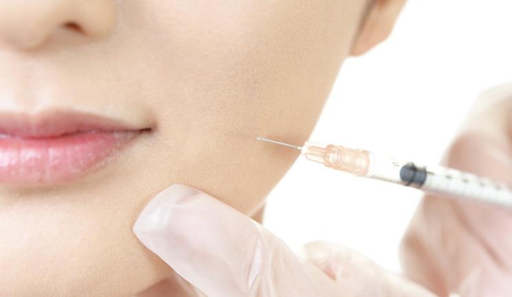 What’s the Best Dermal Filler for Nonsurgical Jawline