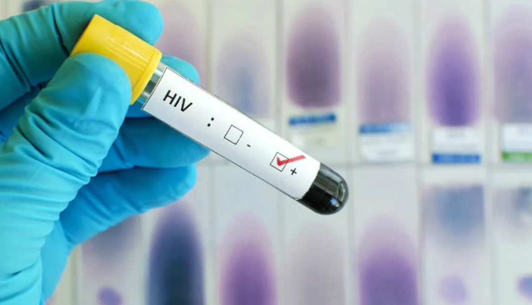 Probarán vacunas contra el VIH en México
