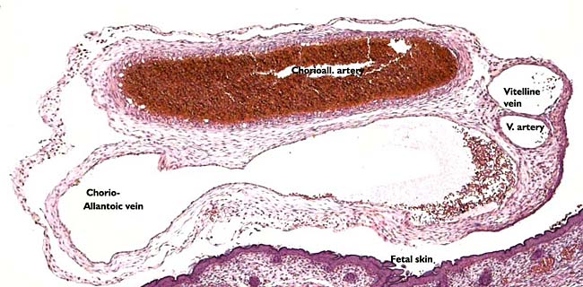 Cross section of umbilical cord still attached to fetal skin (below). Two large allantoic and two smaller vitelline vessels are present.