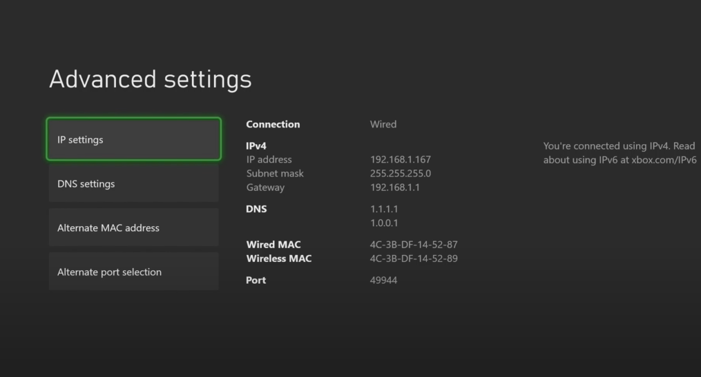 Changing IP settings on Xbox ONe