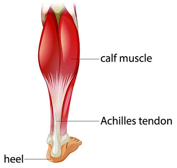 The calf muscle and Achilles tendon for Rossiter Stretching in plantar fasciitis
