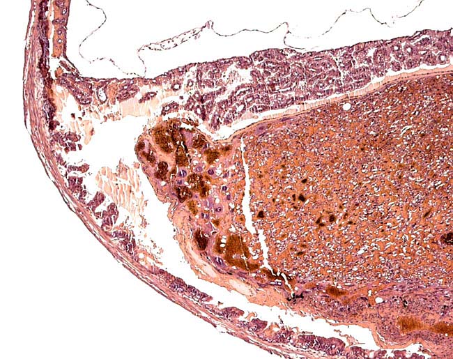 The edge of the placental disk showing endometrium on uterine muscle, yolk sac membrane and delicate amnion on top.