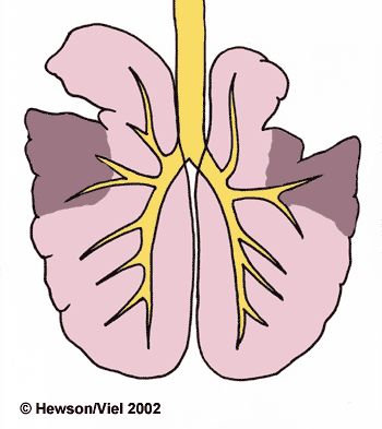 Equine lung diagram highlighting the most frequent sites of abscess formation.