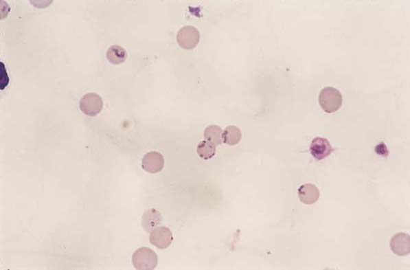 Feline blood. Haemobartonella felis. RBC density on the smear is reduced ...
