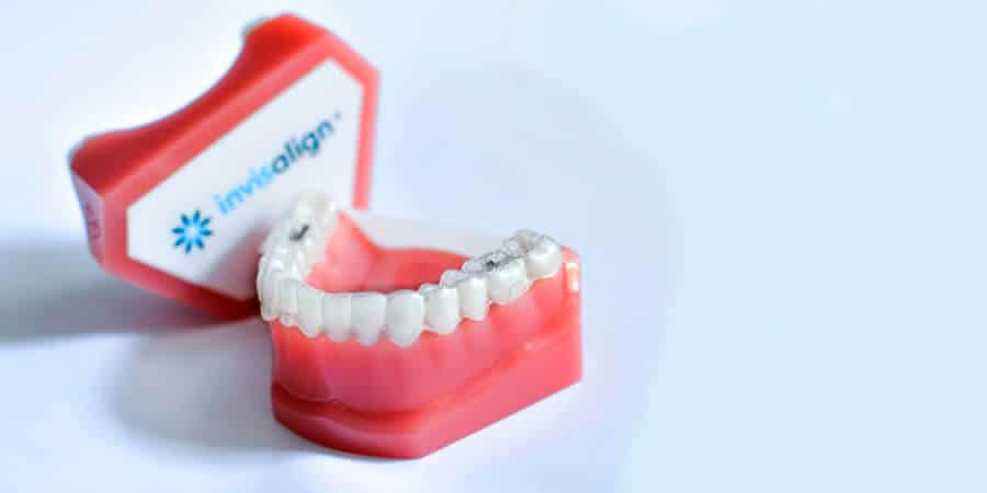 Model aparat dentar Invisalign - Clinica SyroDent Bucuresti