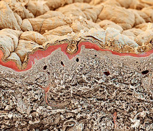 Dry Skin Under Microscope