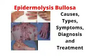 What is Epidermolysis Bullosa (EB)
