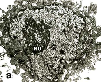 Thin section of a cultured uninfected equine fetal kidney (EFK) cell. NU =nucleolus.