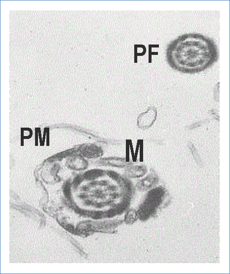 (PF) or tail, the axonema is seen surrounded by dense electron-dense external fibers, a cross section of the middle piece (PM), surrounded by mitochondria (M). Contrast technique with uranyl acetate and lead citrate. Zoom in 12 000x.