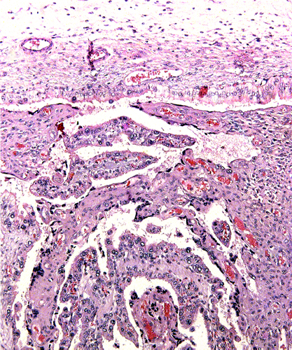 Placental surface of second, better-preserved placenta