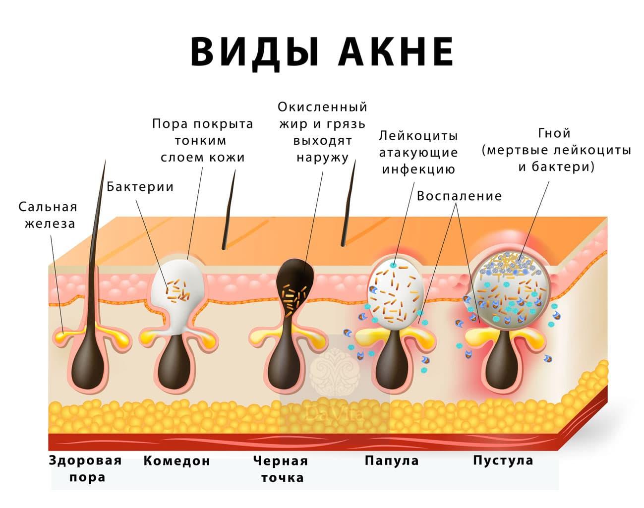 WkURtVISIGlPtakLlThLslnpMpy2HOrRDf_eX6MYfR-weEGFoVjGlf8qfYwdIa4vsNnn-kwOY4j1XOFTYJqooq79N8xuIGmV_p3CNsKESNQ8uN3UoXEBT9OpPx_2sKGzbCIUt2se_1Kl86L3ZG4