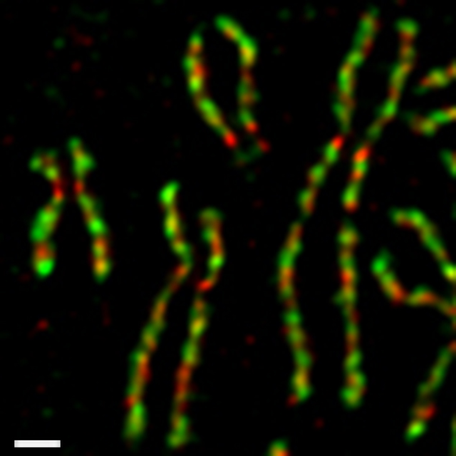 Cromossomos bem espiralizados, como na metáfase