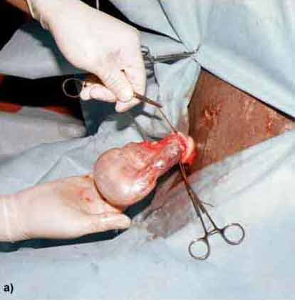 Castration in the dromedary: Ligature of the testicular cord.