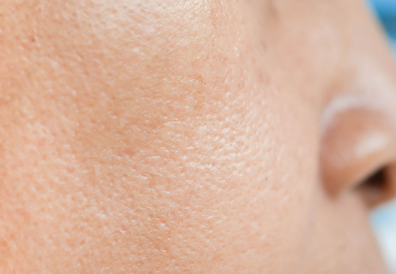 Learn the secrets of minimizing pores!