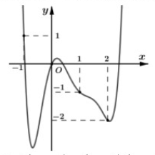 Cho hàm số (y = fleft( x right))có đạo hàm trên (mathbb{R}). Đồ thị hàm số (y = f'left( x right)) là đường cong như hình vẽ bên dưới</p> 1