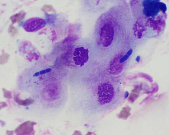 Squamous epithelial cells in TA from a horse. Note presence of Simonsiella spp on the surface of these cells, which is consistent with oropharyngeal contamination.
