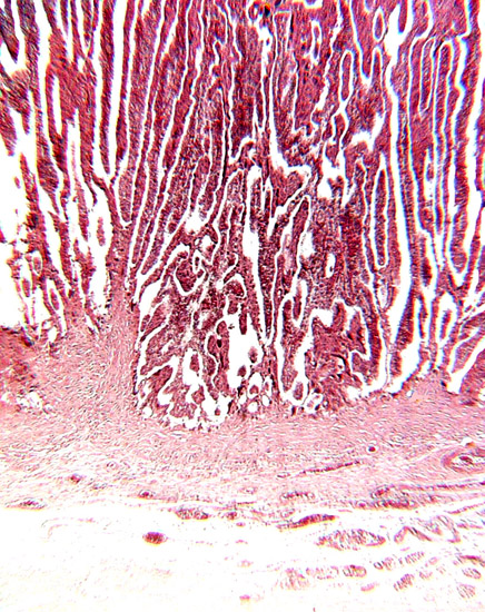 Floor of implanted cotyledon; the myometrium in below and the extensions of the fibrous endometrium extend up between the slender villi