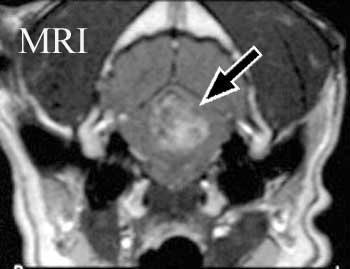 Transverse post-contrast CT versus post-contrast MRI in a dog with cerebellar glioma