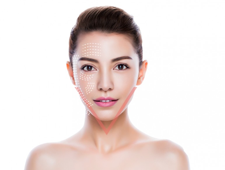 Căng da mặt được xem là phương pháp “cải lão hoàn đồng”, giúp khách hàng cải thiện hiệu quả nếp nhăn, da chảy xệ, kém đàn hồi, một cách nhanh chóng.