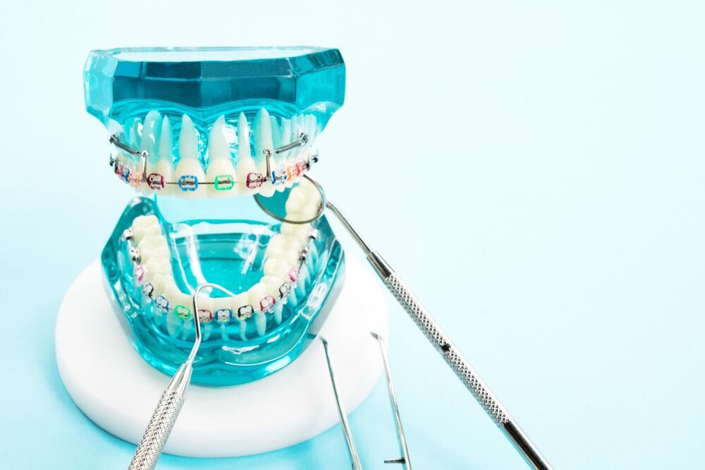 Orthodontics Dentistry | KAM DENTAL