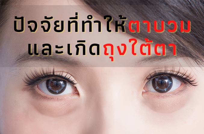 ปัจจัยที่ทำให้ตาบวมและเกิดถุงใต้ตา.png