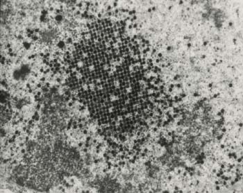 Enlargement of paracrystalline array and virus precursor material. These electron microscopic images formed part of a study reported in [1] while the author was a sabbatic leave visitor at Cornell University.