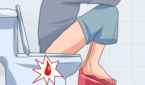 triệu chứng bệnh trĩ nội