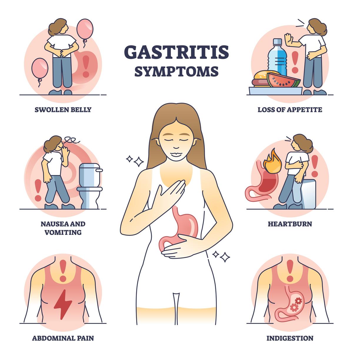 Symptoms of Gastritis