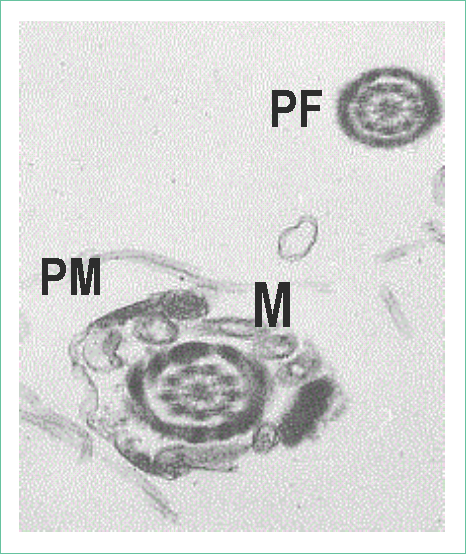 (PF) o cola, se observa el axonema rodeado por fibras densas externas electrodensas, un corte transversal de pieza media (PM) rodeada de mitocondrias (M). Técnica de contraste con acetato de uranilo y citrato de plomo. Aumento 12 000X.