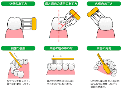無料ダウンロード 歯磨き ���ラスト 簡単 198781-簡単 イラスト 歯磨き