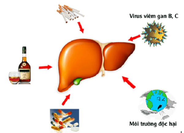 Men gan tăng cao có thể là do những tác nhân đến từ môi trường bên ngoài