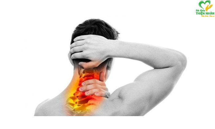 Đau dây thần kinh cổ vai gáy: Điều trị thế nào cho hiệu quả?