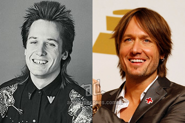 The new smile of Keith Urban, afterdental surgery