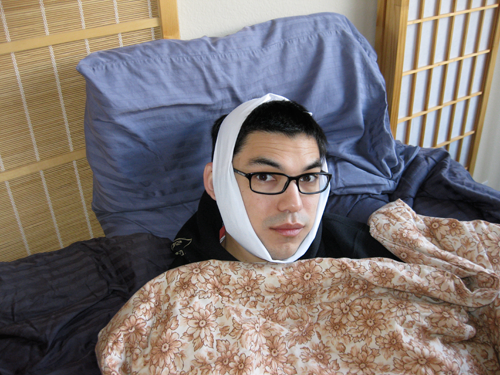 Wisdom Teeth