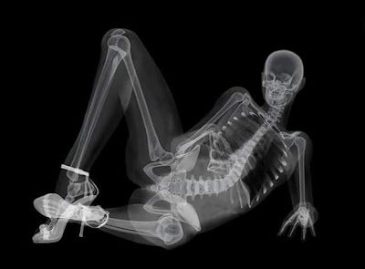 foto x-ray seksi