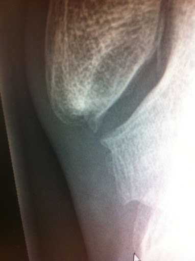 Ankle.JPG