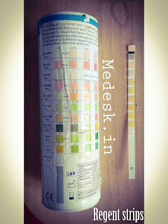 Chemical examination or urine
