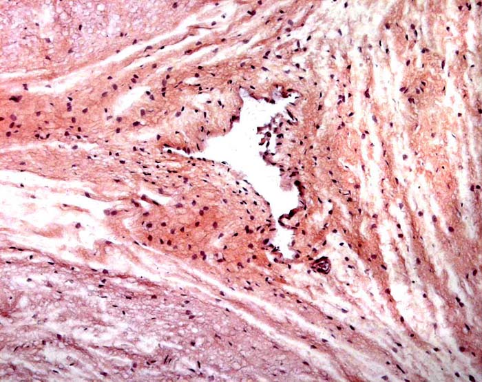 Allantoic duct in the center of the umbilical cord. Other than the three large umbilical vessels, there are no smaller blood vessels associated with the duct.