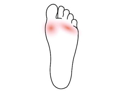 Under foot pain causes 293979-Under foot pain causes