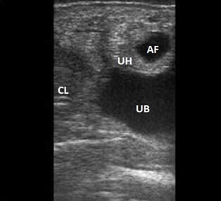 Ultrasonographic image of a 28 day old pregnancy in a water buffalo female. Corpus Luteum (CL), Urinary bladder (UB), and the spherical and symmetric uterine horn (UH) filled with amniotic fluid (AF).